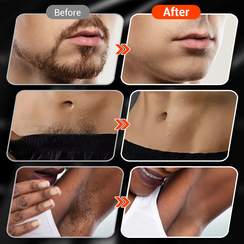 SmoothEdge – Compact Rotary Electric Shaver for Men