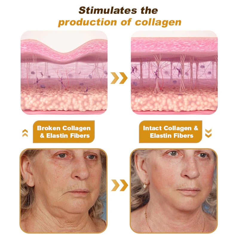 BeeYouth – Botox & Bee Venom Wrinkle Cream