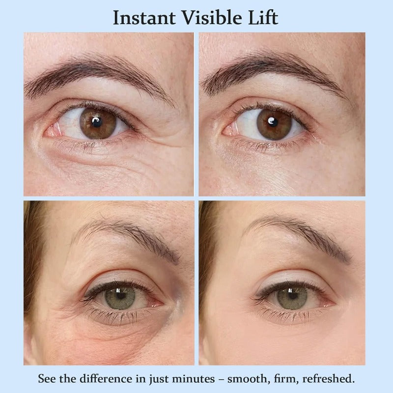 LumiLift – Instant Eye Lift & Refreshing Cream