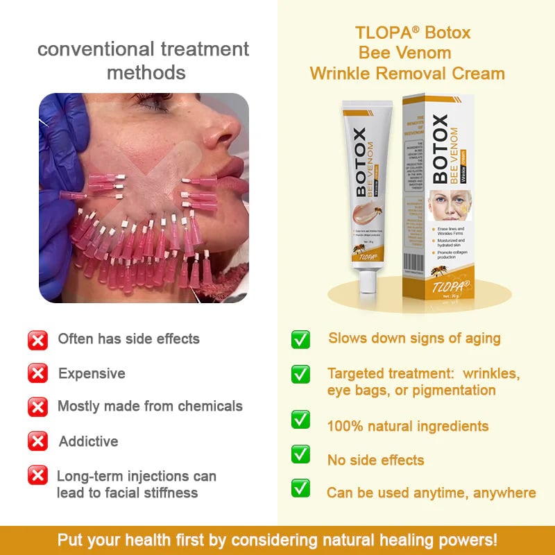 BeeYouth – Botox & Bee Venom Wrinkle Cream