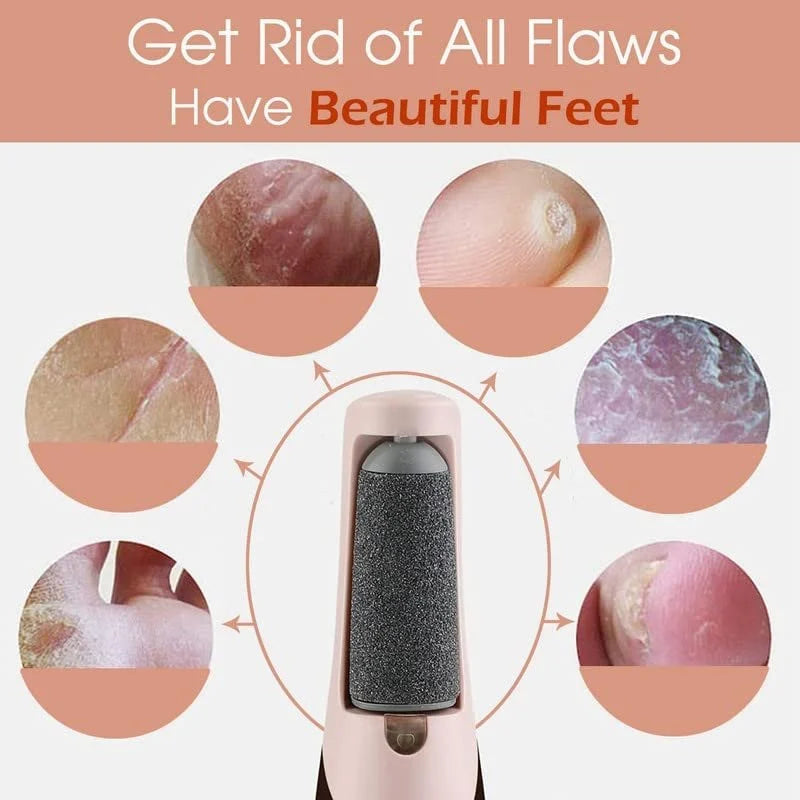 SoleSmooth - Electric Foot Callus Remover