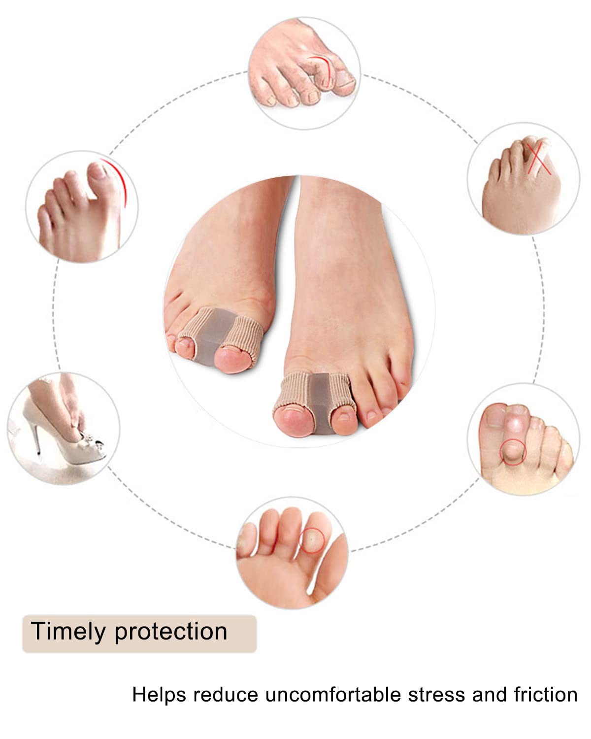 AlignMate - Soft & Supportive Toe Correctors