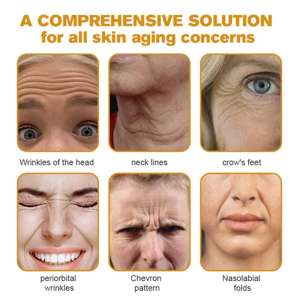 BeeYouth – Botox & Bee Venom Wrinkle Cream