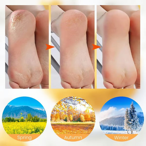 SoleSilk – Hydrating Foot Mask Socks