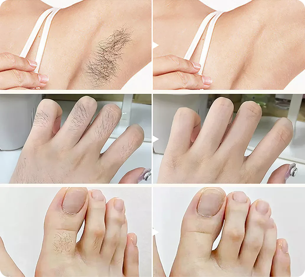 SmoothAway – Hair Removal Cream Kit