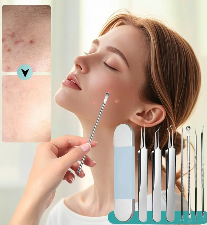 DermaSteel – Precision Stainless Steel Pore Cleaner Kit