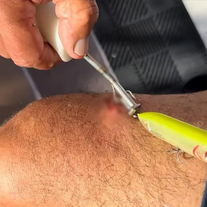 HookEase – Quick Release Fish Hook Remover Tool