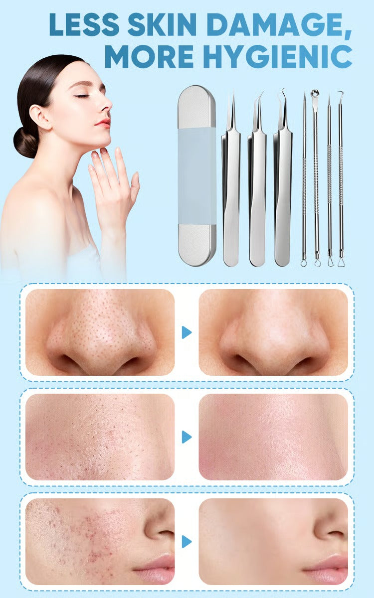 DermaSteel – Precision Stainless Steel Pore Cleaner Kit