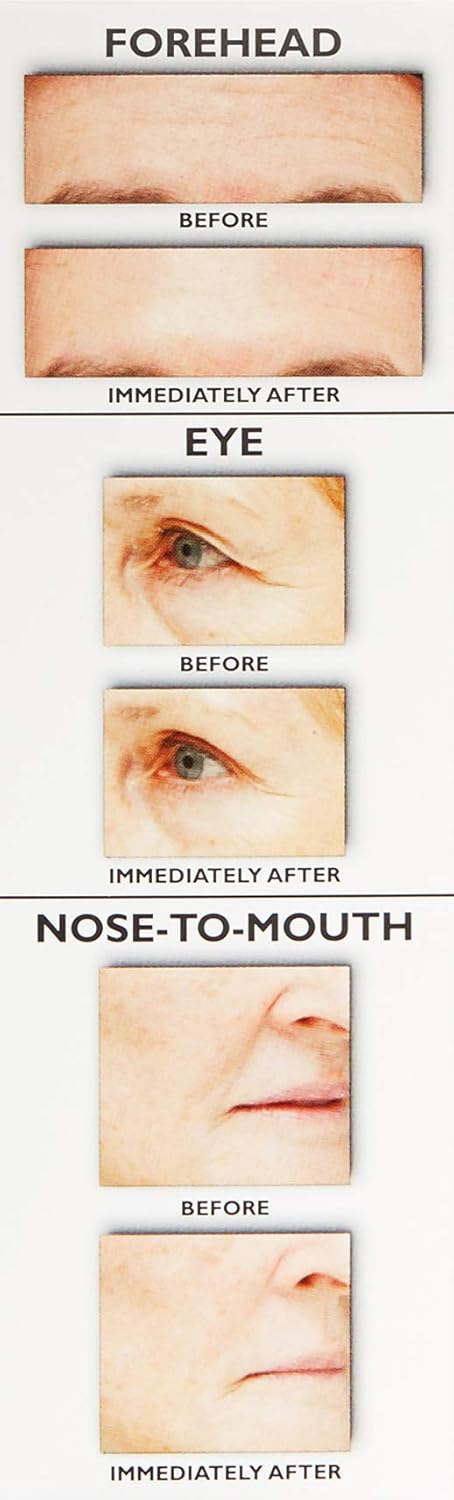 SmoothLift – Temporary Face Firming Solution