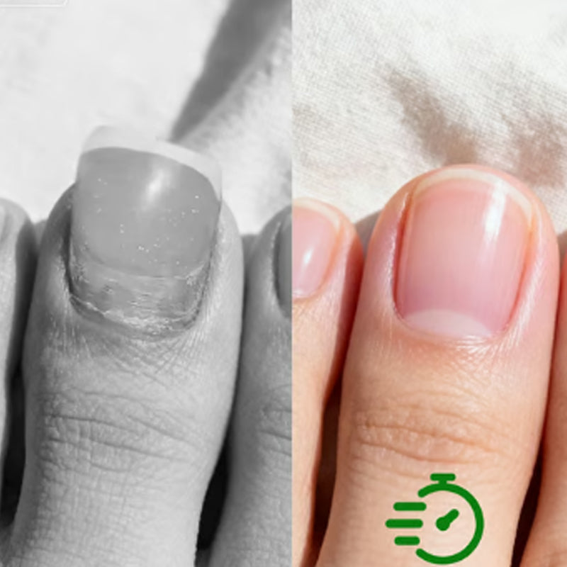 NailBloom - Botanical Nail Repair Elixir