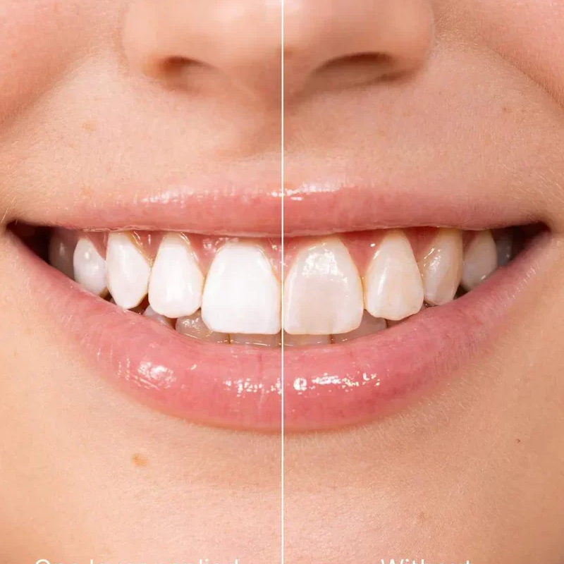 WhiteFlash – Instant Tooth Whitening Paint