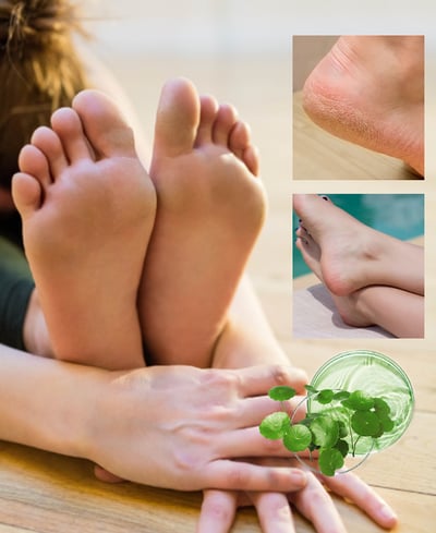 GingerStep – Nourishing Foot Spray