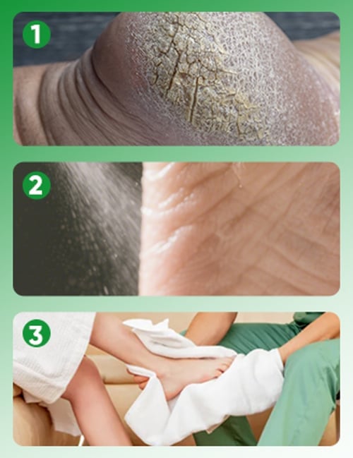 GingerStep – Nourishing Foot Spray